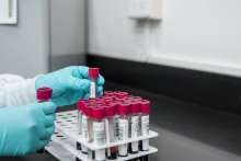 Coronavirus Antibody Count: How to Check Zagreb Vaccine Results?