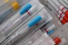 Changes to Way Croatian Epidemiologists Contact Patients and Contacts
