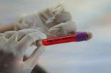 Epidemiologist Branko Kolaric Unsure About Herd Immunity Through Omicron