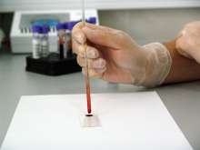 Rijeka Hospital Dismissals as Expensive Items Found Hidden in Cellar