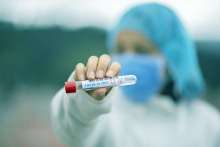 Vili Beros Reveals New Coronavirus Test Price for Croatia