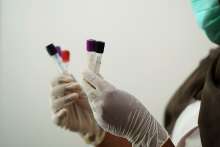 New Zagreb Coronavirus Testing Site With Good Parking Capacities Opened