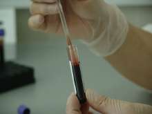 Croatian Immunologist to Head EU Federation With 14,000 Researchers