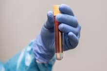 Croatian Police Discover Over 700 Fake PCR Tests So Far This Year