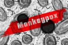 First Case of Monkeypox in Croatia Confirmed
