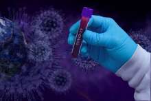 Croatia's Coronavirus Update: 1,835 New Cases, Seven Deaths